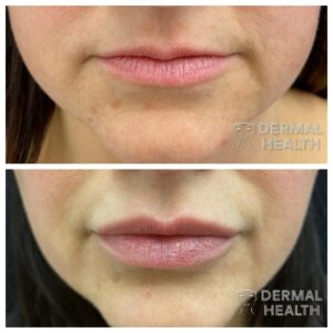 beautiful lips case study 2