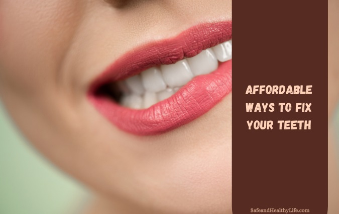 Budget-friendly Ways to Repair Your Teeth